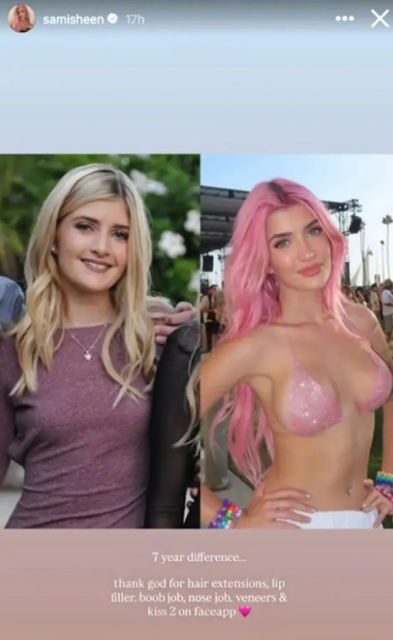 Sami Sheen, înainte și după operații estetice