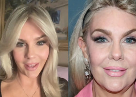 Val de reacții după ce o femeie de 61 de ani a spulberat miturile despre intervențiile estetice: „Ar trebui să fim mândre”