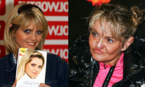 Coșmarul operațiilor pentru o actriță britanică. Încearcă să-și reconstruiască fața, după ani de vicii, excese și intervenții eșuate