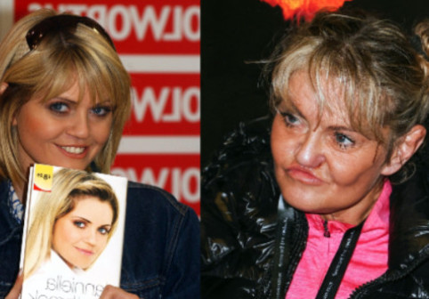 Coșmarul operațiilor pentru o actriță britanică. Încearcă să-și reconstruiască fața, după ani de vicii, excese și intervenții eșuate