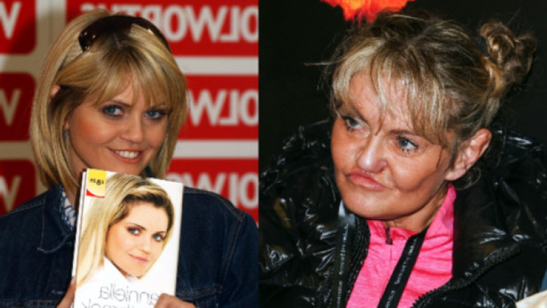 Coșmarul operațiilor pentru o actriță britanică. Încearcă să-și reconstruiască fața, după ani de vicii, excese și intervenții eșuate