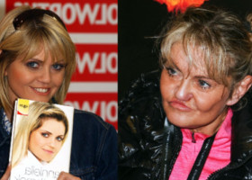 Coșmarul operațiilor pentru o actriță britanică. Încearcă să-și reconstruiască fața, după ani de vicii, excese și intervenții eșuate