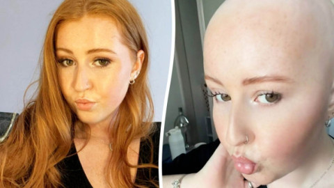 Medicii i-au pus durerile pe seama unei întinderi musculare, dar diagnosticul de la 22 de ani a dărâmat-o: Știam că ceva nu e în regulă