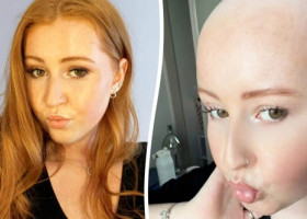 Medicii i-au pus durerile pe seama unei întinderi musculare, dar diagnosticul de la 22 de ani a dărâmat-o: Știam că ceva nu e în regulă