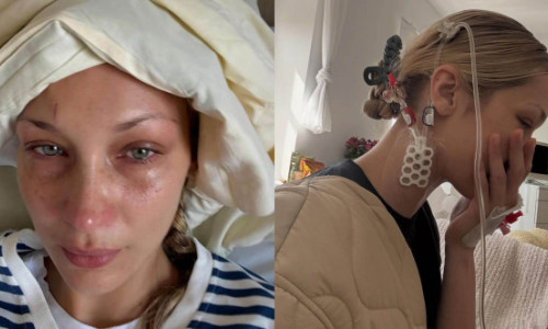 Bella Hadid, imagini cutremurătoare de pe patul de spital: lupta paralizantă cu boala Lyme