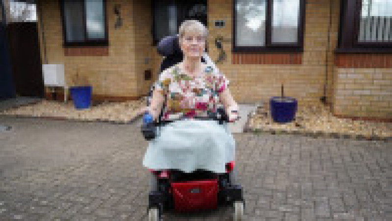 Kim Smith, de 61 de ani, și-a pierdut mâinile și picioarele după ce o infecție a tractului urinar a dus la sepsis, după o vacanță petrecută în Spania, în 2017 FOTO: Profimedia Images | Poza 6 din 10