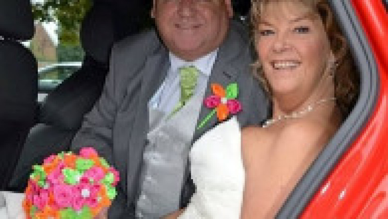 Kim Smith, de 61 de ani, și-a pierdut mâinile și picioarele după ce o infecție a tractului urinar a dus la sepsis, după o vacanță petrecută în Spania, în 2017 FOTO: Profimedia Images | Poza 3 din 10