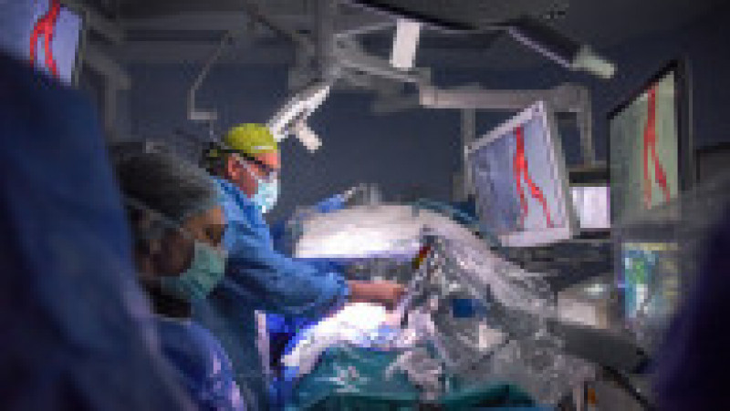 Inteligența artificială, utilizată în chirurgia cardiovasculară minim invazivă, la Sanador | Poza 4 din 4