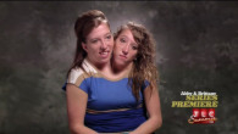 Abby și Brittany Hensel au avut propriul reality show la TLC FOTO: Profimedia Images | Poza 13 din 15
