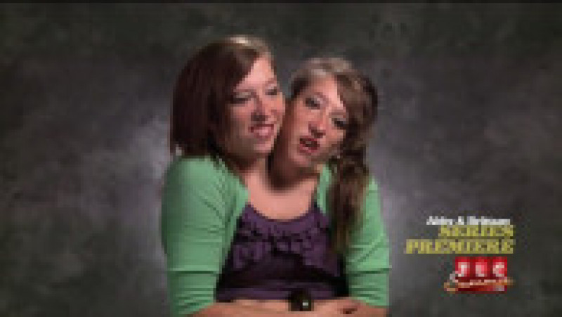 Abby și Brittany Hensel au avut propriul reality show la TLC FOTO: Profimedia Images | Poza 14 din 15