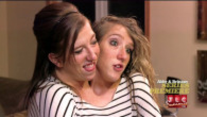 Abby și Brittany Hensel au avut propriul reality show la TLC FOTO: Profimedia Images | Poza 12 din 15
