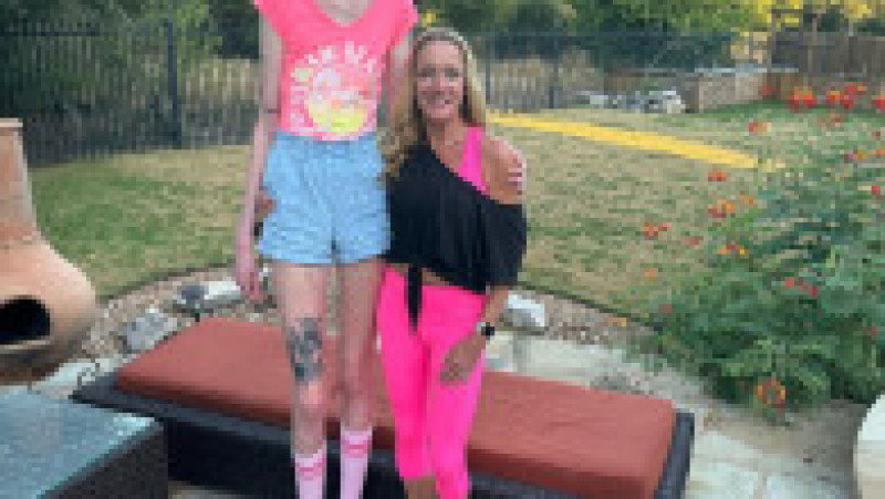 Macy Koren, 21 anni, di Austin, Texas, detiene il record per le gambe più lunghe del mondo Foto: Provimedia Images |  Immagine 12 di 18