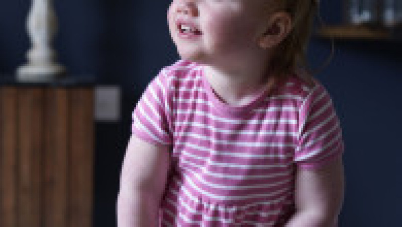 Opal Sandy, în vârstă de 18 luni, s-a născut complet surdă din cauza unei afecţiuni numite neuropatie auditivă. Foto: Profimedia Images | Poza 2 din 5