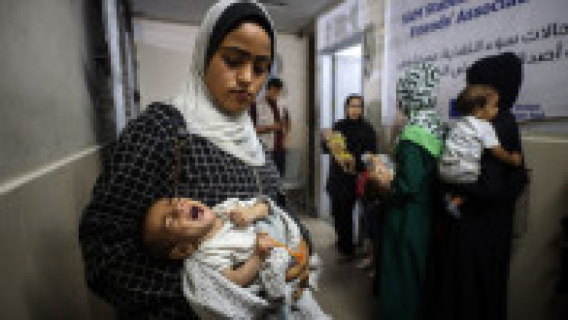 Malnutriția severă la copiii sub 5 ani s-a triplat la clinica din orașul Gaza, potrivit rapoartelor organizațiilor caritabile. Sursa: Profimedia | Poza 8 din 12