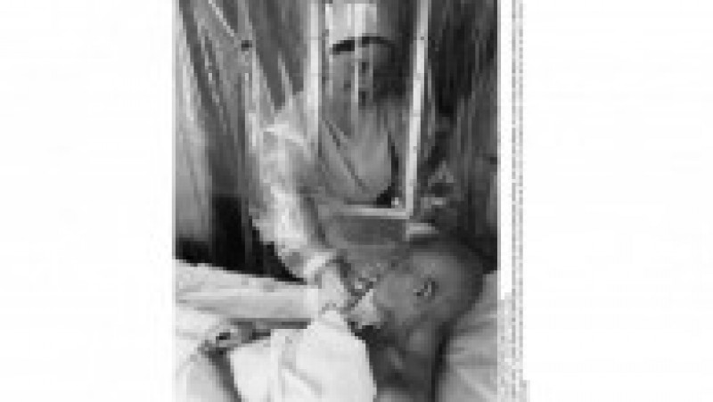 cernobil pacient - profimedia | Poza 8 din 8