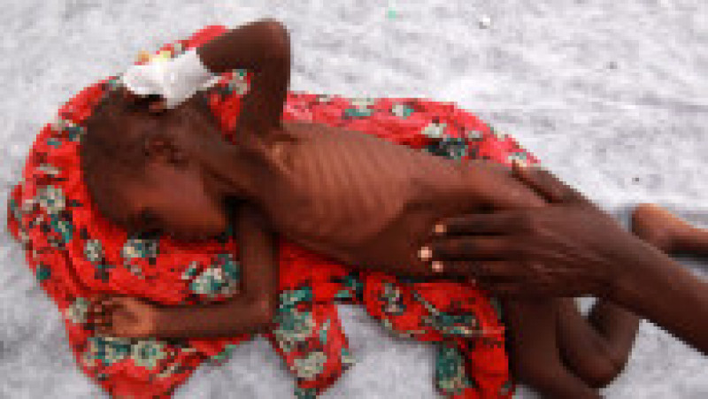 Somali Famine Refugees Seek Aid In Mogadishu | Poza 5 din 10