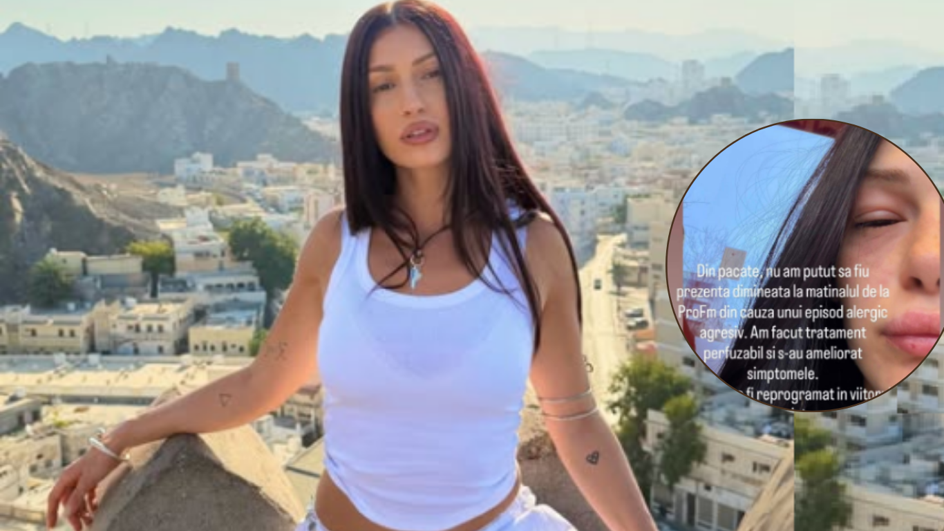 Alina Eremia, imagini cu fața tumefiată și ochii umflați. Artista a ajuns la medic după o reacție alergică severă