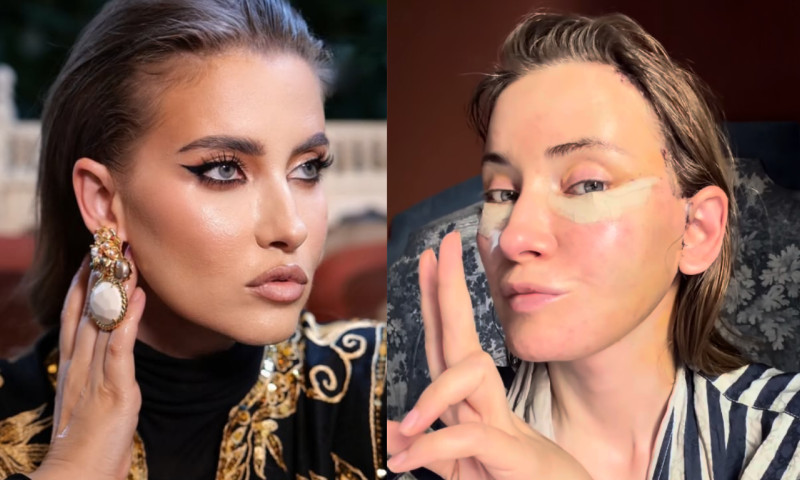 iulia. Albu faceliftV2siteMusicCh (17)